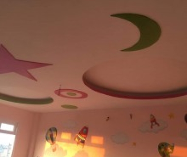 Thạch cao mẫu 15